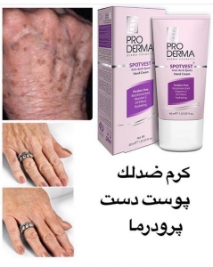 کرم روشن کننده و ضد لک مناسب برای پوست دست SPOTVEST پرودرما